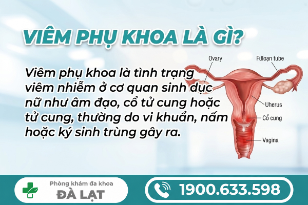 Hình ảnh minh họa